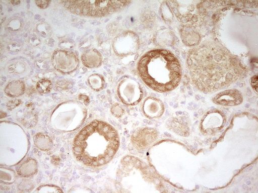 m01723 pak4 primary antibodies ihc testing 6_1