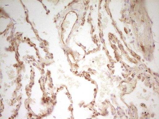 m01723 pak4 primary antibodies ihc testing 7_1