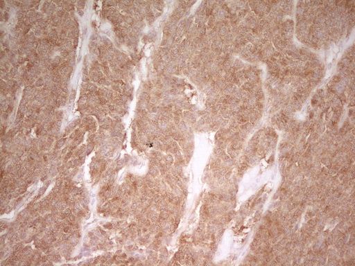 m01723 pak4 primary antibodies ihc testing 8_1