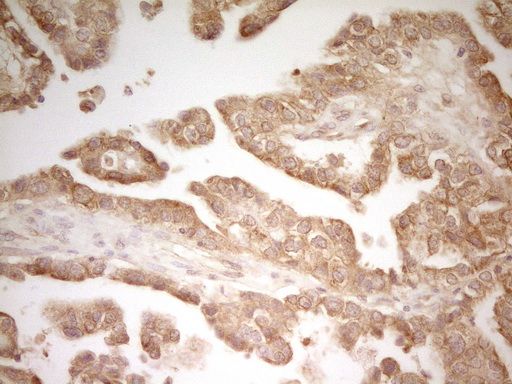 m01723 pak4 primary antibodies ihc testing 9_1