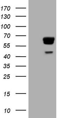 HEK293T cells were transfected with the pCMV6-ENTRY control (Left lane) or pCMV6-ENTRY PAK4 (Right lane) cDNA for 48 hrs and lysed