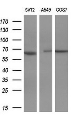 Western blot analysis of extracts (10ug) from 3 different cell lines by using anti-PAK4 monoclonal antibody (1:1000)
