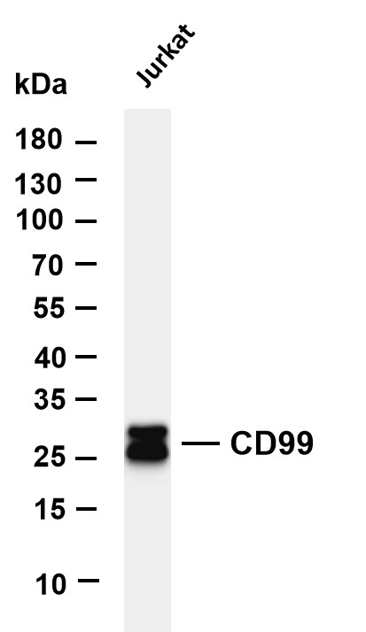 Various whole cell lysates were separated by 4-20% SDS-PAGE, and the membrane was blotted with anti-CD99 antibody