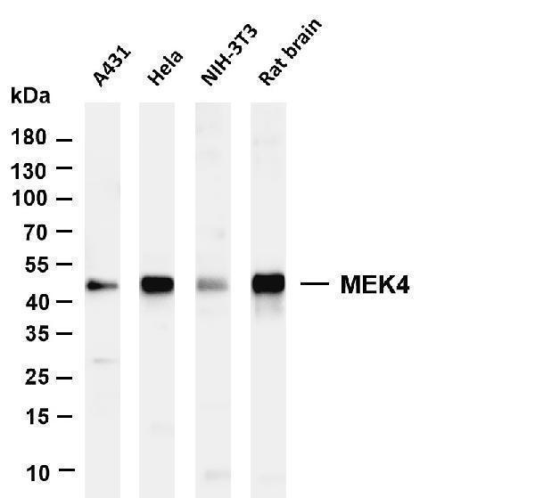 Various whole cell lysates were separated by 4-20% SDS-PAGE, and the membrane was blotted with anti-MEK4 antibody