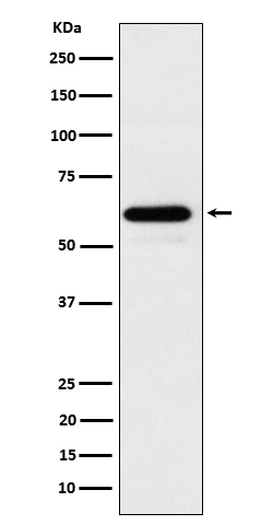 Western blot analysis of HRPT2/CDC73 expression in 293T cell lysate