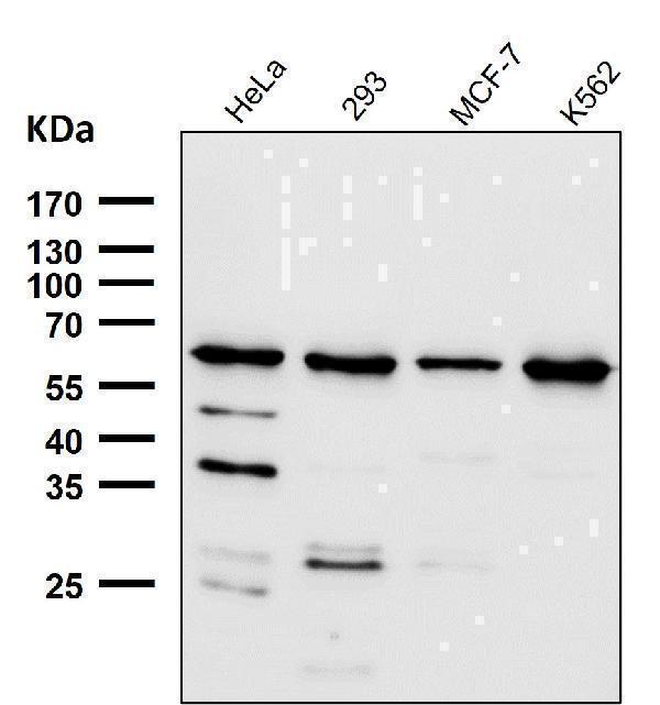 All lanes use the Antibody at 1:1K dilution for 1 hour at room temperature