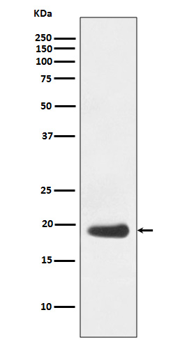 Western blot analysis of eIF5A expression in Jurkat cell lysate