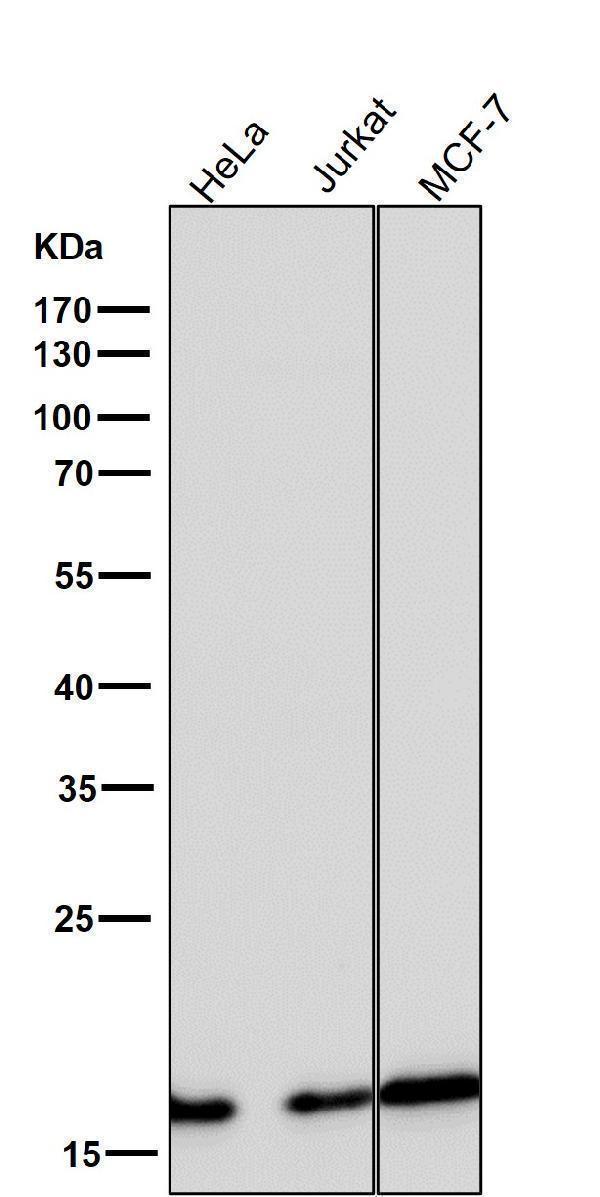 All lanes use the Antibody at 1:5K dilution for 1 hour at room temperature