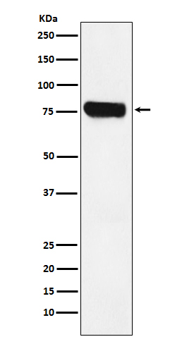 Western blot analysis of HEC1 expression in Jurkat cell lysate