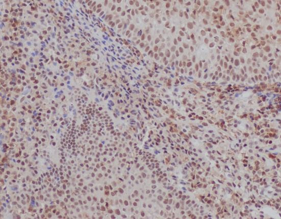m01732 1 ihc