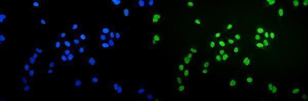 m01732 3 ku70 primary antibodies if testing 6