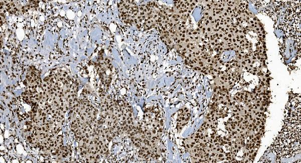 m01732 3 ku70 primary antibodies ihc testing 2