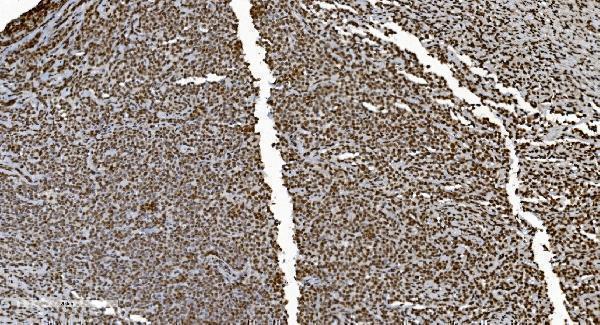 m01732 3 ku70 primary antibodies ihc testing 3