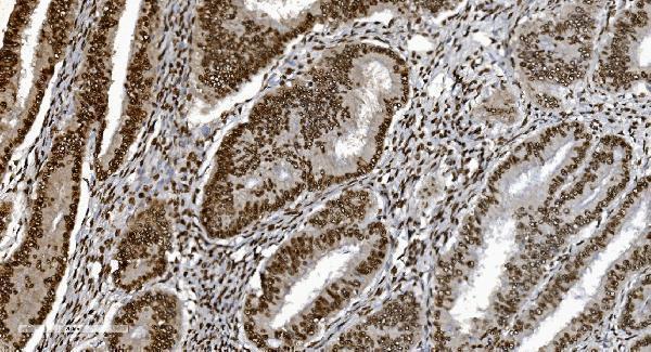 m01732 3 ku70 primary antibodies ihc testing 4