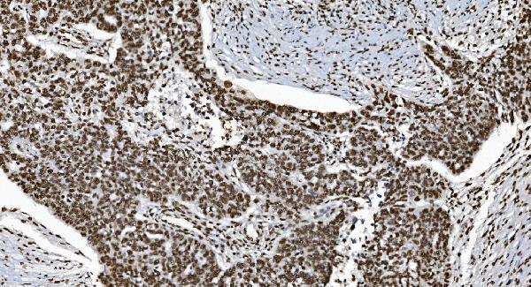 m01732 3 ku70 primary antibodies ihc testing 5