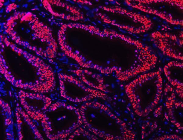 m01732 4 ku70 primary antibodies if testing 10