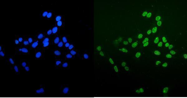 m01732 4 ku70 primary antibodies if testing 8