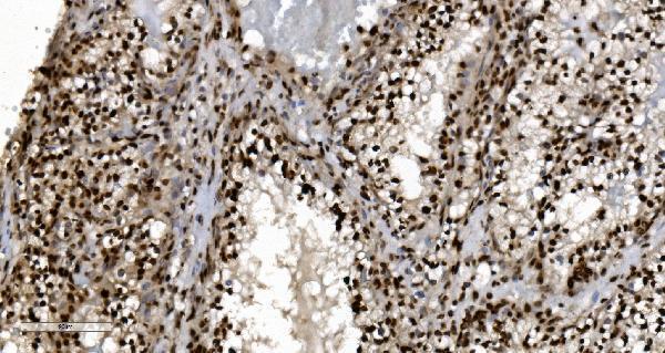 m01732 4 ku70 primary antibodies ihc testing 2