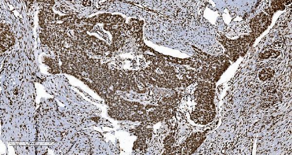 m01732 4 ku70 primary antibodies ihc testing 3