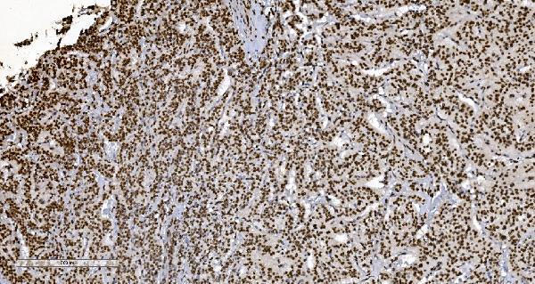 m01732 4 ku70 primary antibodies ihc testing 4