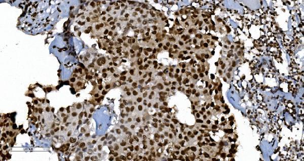 m01732 4 ku70 primary antibodies ihc testing 5