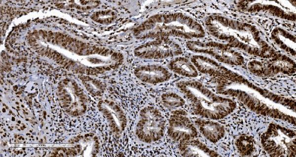 m01732 4 ku70 primary antibodies ihc testing 6