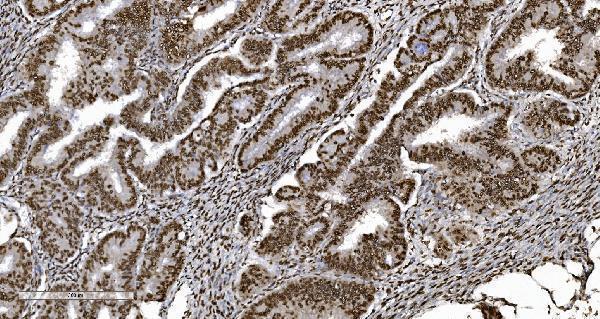 m01732 4 ku70 primary antibodies ihc testing 7