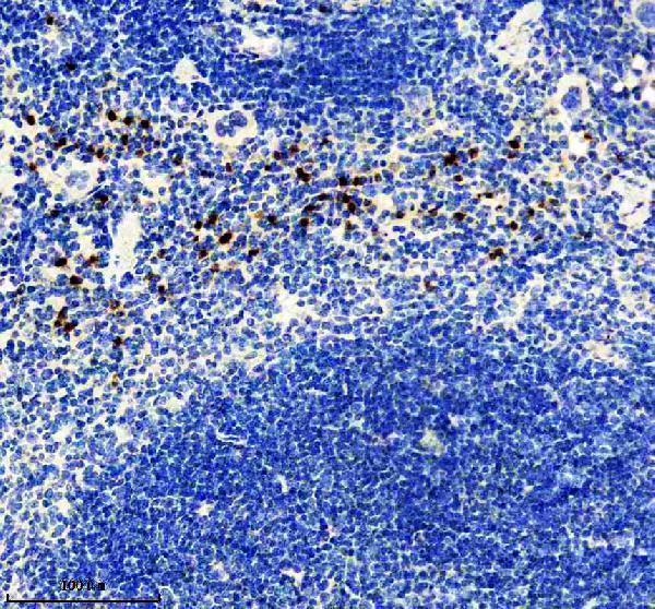 m01733 mmp8 primary antibodies ihc testing 2