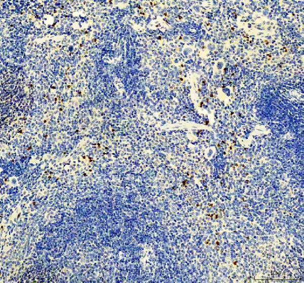 m01733 mmp8 primary antibodies ihc testing 3