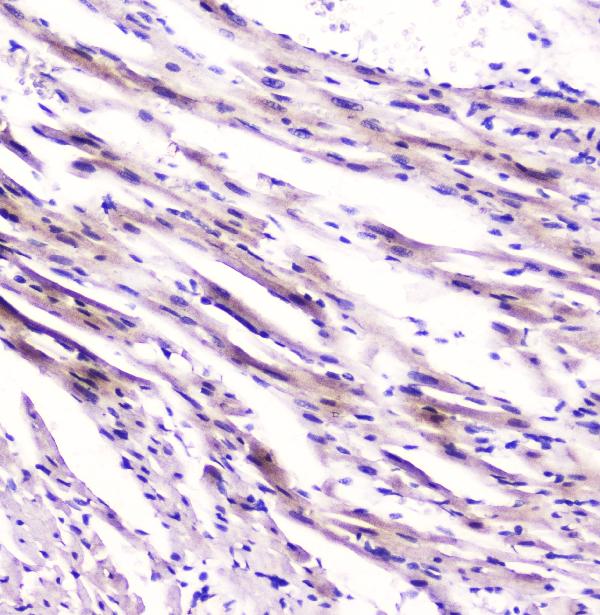 IHC analysis of Cardiac FABP using anti-Cardiac FABP antibody (M01734). Cardiac FABP was detected in paraffin-embedded section of rat cardiac muscle tissue. Heat mediated antigen retrieval was performed in citrate buffer (pH6, epitope retrieval solution) for 20 mins. The tissue section was blocked with 10% goat serum. The tissue section was then incubated with 2μg/ml rabbit anti-Cardiac FABP Antibody (M01734) overnight at 4°C. Biotinylated goat anti-rabbit IgG was used as secondary antibody and incubated for 30 minutes at 37°C. The tissue section was developed using Strepavidin-Biotin-Complex (SABC)(Catalog # SA1022) with DAB as the chromogen.