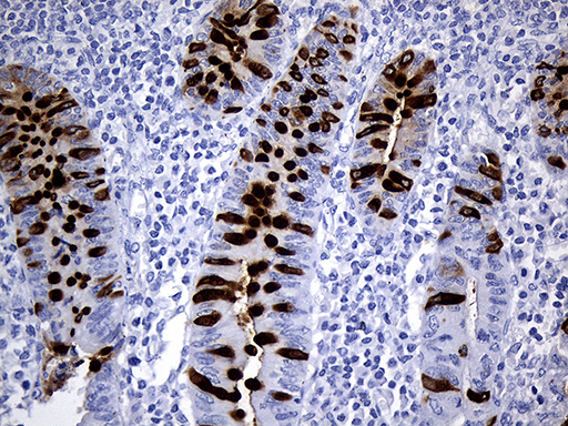m01738 1 anti trefoil factor 3 tff3 mouse monoclonal antibody clone id oti5b2 ihc testing 5