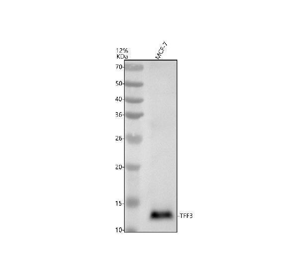 Western blot analysis of Trefoil factor 3/TFF3 using anti-Trefoil factor 3/TFF3 antibody (M01738)