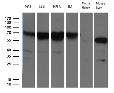 Western blot analysis of extracts (35ug) from 4 different cell lines and 2 different tissue lysates by using anti-FMO3 monoclonal antibody (1:500)