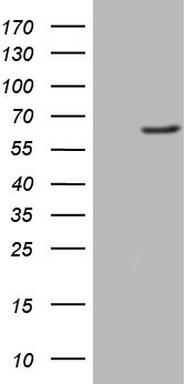 HEK293T cells were transfected with the pCMV6-ENTRY control (Left lane) or pCMV6-ENTRY FMO3 (Right lane) cDNA for 48 hrs and lysed
