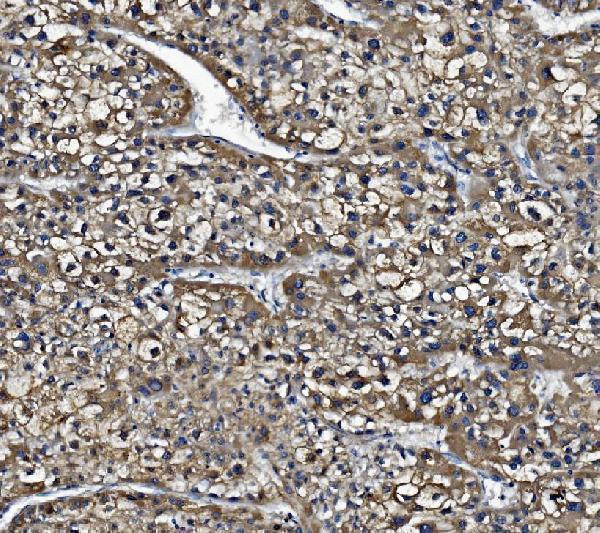 m01741 1 ces1 primary antibodies ihc testing 4