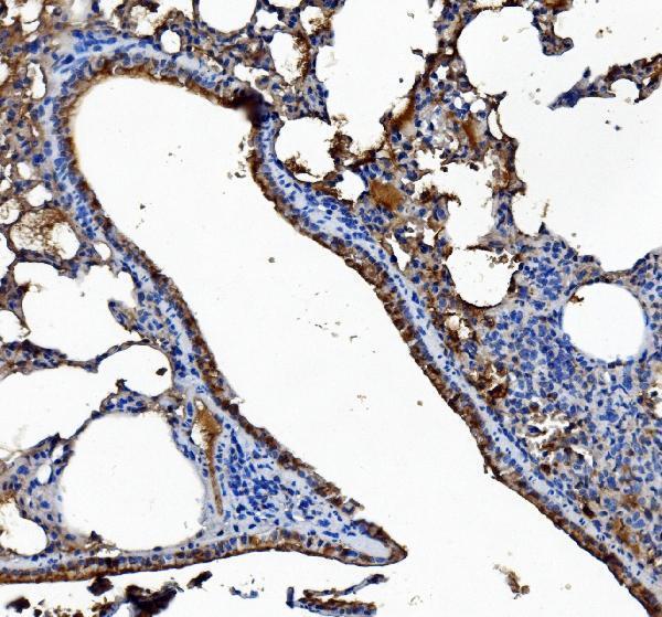m01741 1 ces1 primary antibodies ihc testing 7