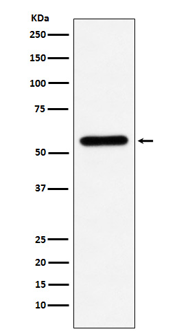 Western blot analysis of Liver Carboxylesterase 1 expression in U937 cell lysate