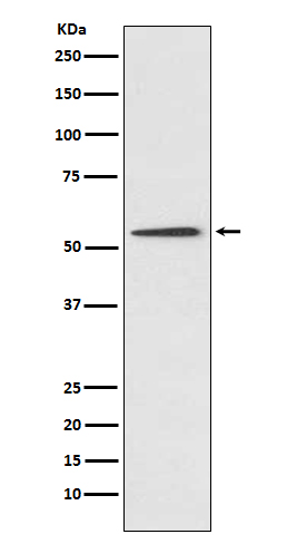 Western blot analysis of Protein C expression in HepG2 cell lysate