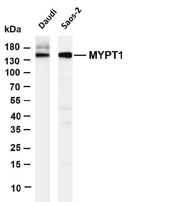 Various whole cell lysates were separated by 4-20% SDS-PAGE, and the membrane was blotted with anti-MYPT1 antibody