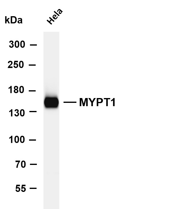 Various whole cell lysates were separated by 4-8% SDS-PAGE, and the membrane was blotted with anti-MYPT1 antibody