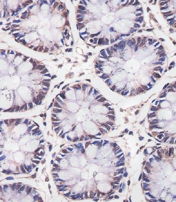 M01746-1 staining MBD2 in human colon tissue sections by Immunohistochemistry (IHC-P -paraformaldehyde-fixed, paraffin-embedded sections)