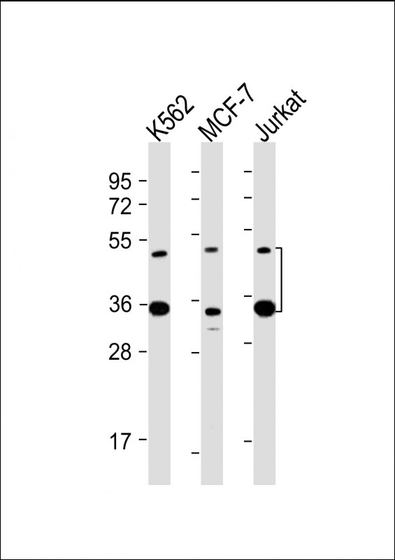 All lanes : Anti-MBD2 Antibody at 1:2000 dilutionLane 1: K562 whole cell lysateLane 2: MCF-7 whole cell lysateLane 3: Jurkat whole cell lysateLysates/proteins at 20 µg per lane