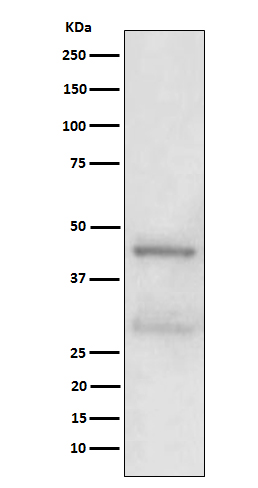 Western blot analysis of MBD2 expression in A431 cell lysate
