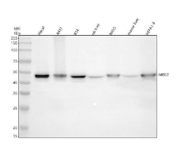 m01746 mbd2 primary antibodies wb testing 1