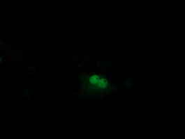 m01747 anti beta trcp btrc mouse monoclonal antibody clone id oti2h2 if testing 5