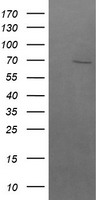 HEK293T cells were transfected with the pCMV6-ENTRY control (Left lane) or pCMV6-ENTRY BTRC (Right lane) cDNA for 48 hrs and lysed