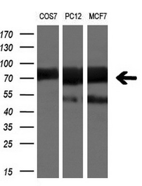 Western blot analysis of extracts (10ug) from 3 different cell lines by using anti-BTRC monoclonal antibody at 1:200 dilution
