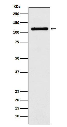 Western blot analysis of DPYD expression in HeLa cell lysate