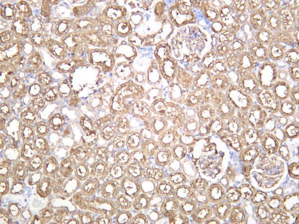 m01750 2 ezr primary antibodies ihc testing 4