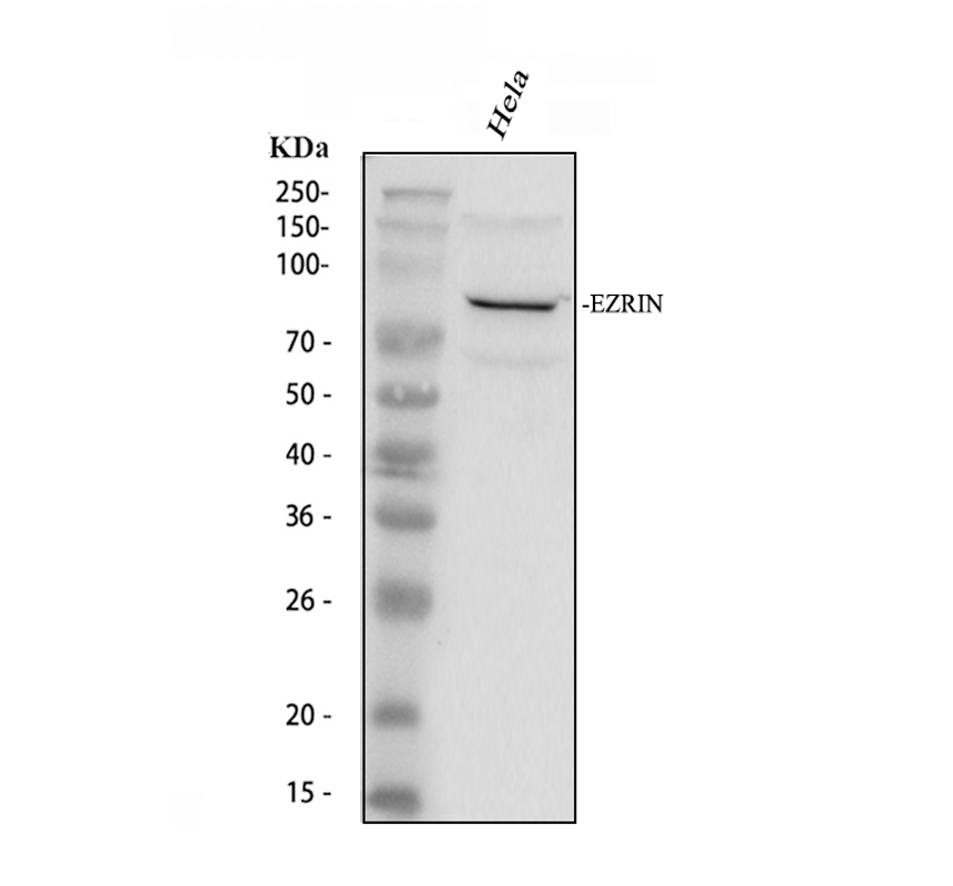 m01750 ezrin primary antibodies wb testing 1